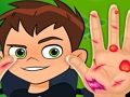 Spēle Ben10 rokas ārsts online Spēle Ben10 rokas ārsts online