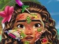 Spēle Ādas ārsts Moana online Spēle Ādas ārsts Moana online