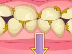 Spēle Bad Teeth Makeover online