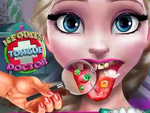 Spēle Ice Queen Tongue Doctor online