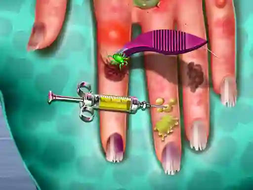 Spēle Hand Skin Doctor online