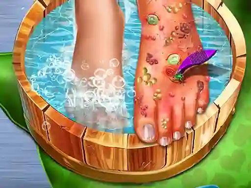 Spēle Feet Skin Doctor online