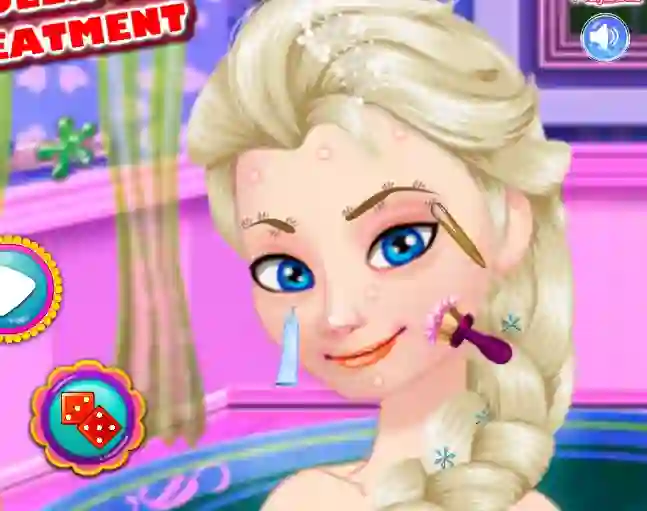 Spēle Ice Queen Acne Treatment online
