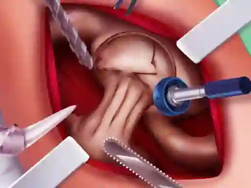 Spēle Princess Hips Surgery online