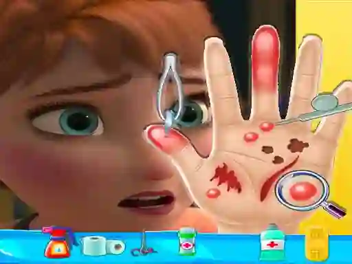 Spēle Anna hand doctor online