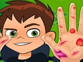 Spēle Ben10 rokas ārsts  online